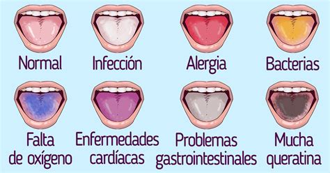 lengua normal y anormal - dolor de cabeza y ojos